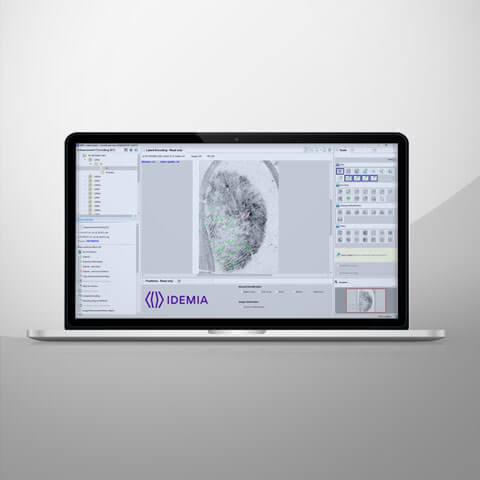 Case AFIS IDEMIA Case AFIS IDEMIA